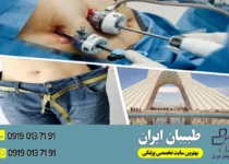 بهترین جراح اسلیو معده در تهران - طبیبان ایران