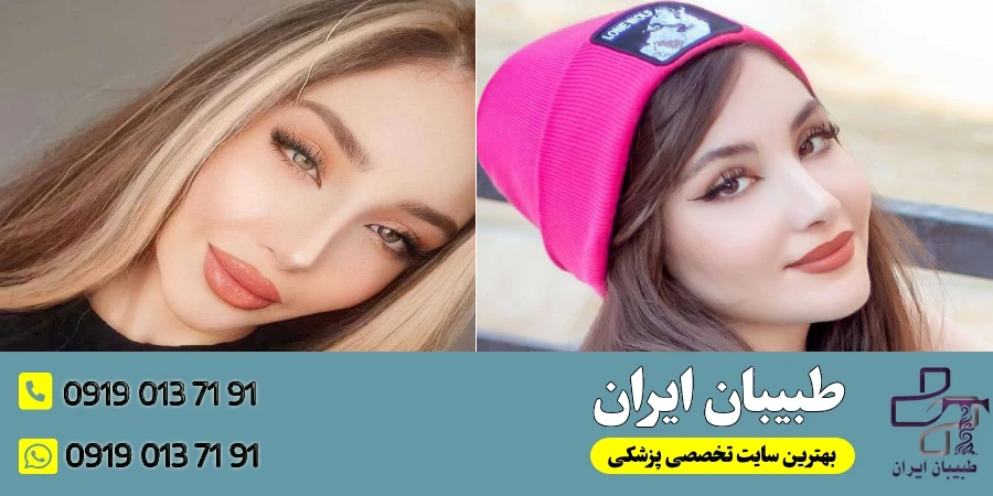 نمونه کار جراحان بینی به سبک وی 1- دکتر آرزو خوانساری نیا
