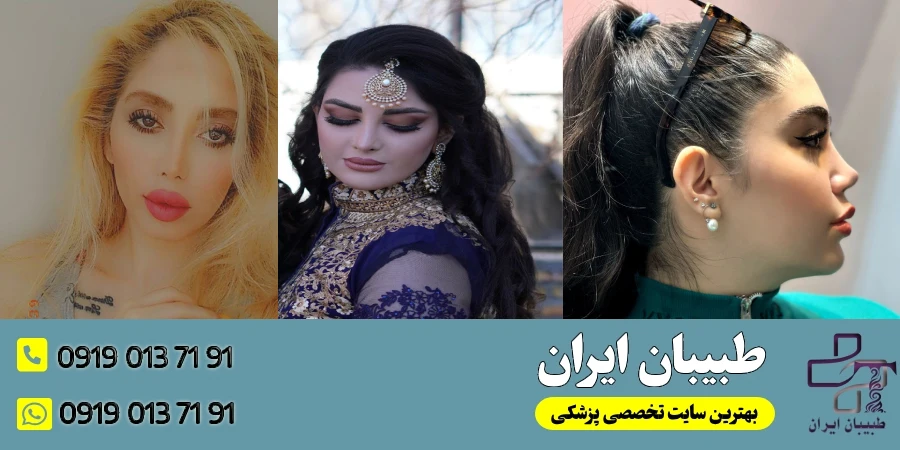 نمونه کارهای جراحان بینی به سبک وی 1- دکتر خسرو مقتدر