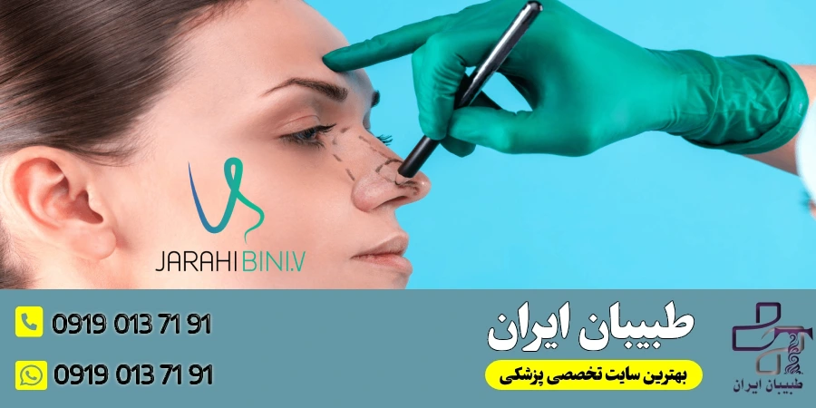 جراحی بینی به سبک وی