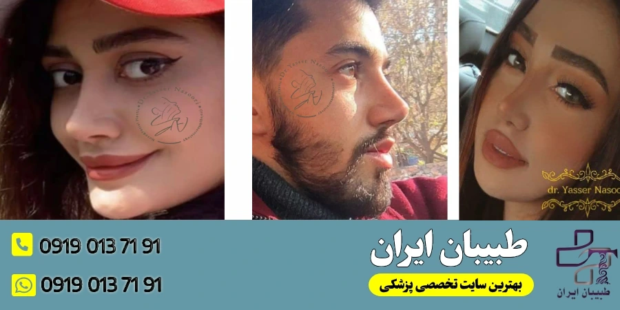 دکتر یاسر نصوری (بهترین جراح بینی به سبک وی در تهران)