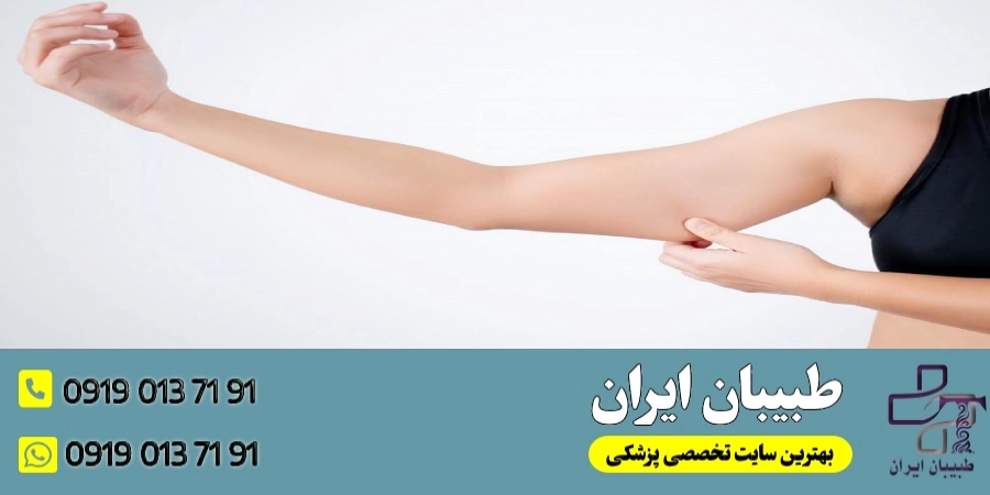 افتادگی و شلی پوست پس از بای پس معده- طبیبان ایران