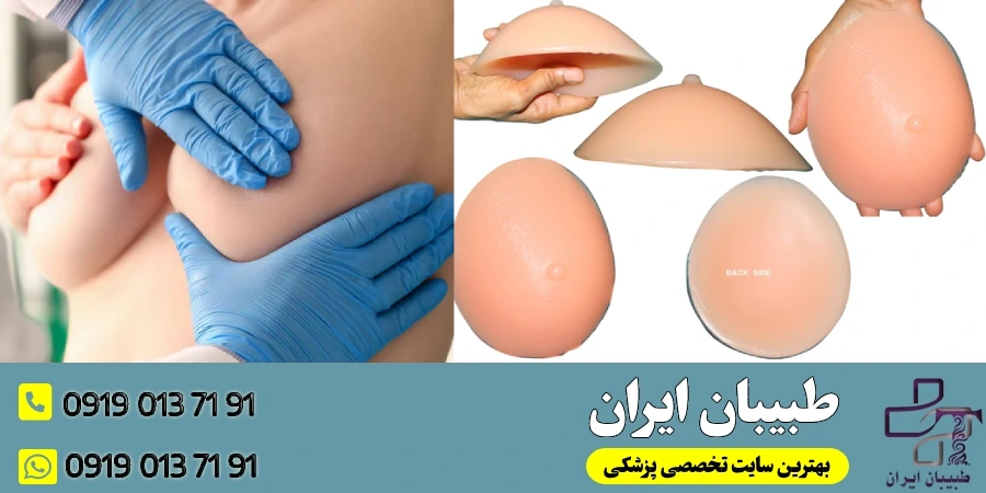 انتخاب نوع پروتز و روش جراحی مناسب