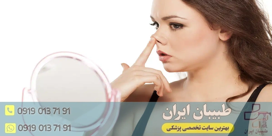 اشتباهات رایج در انتخاب جراح بینی و راه‌های جلوگیری از آن