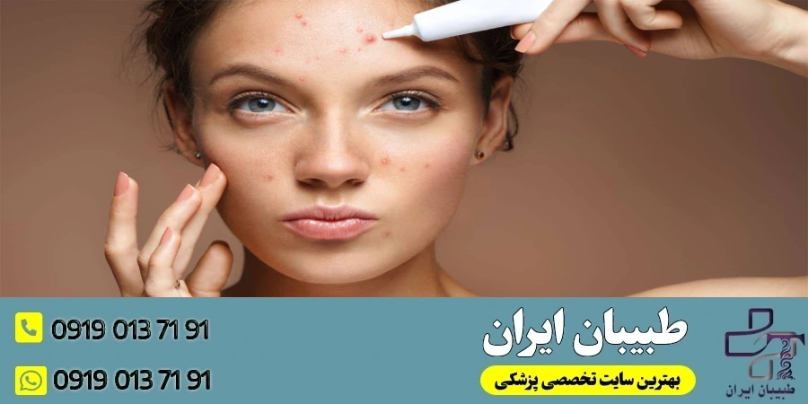 درمان‌های پزشکی و دارویی برای کاهش آکنه بعد از عمل بینی