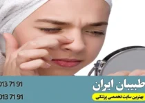 دلایل بروز آکنه بعد از عمل بینی- طبیبان ایران