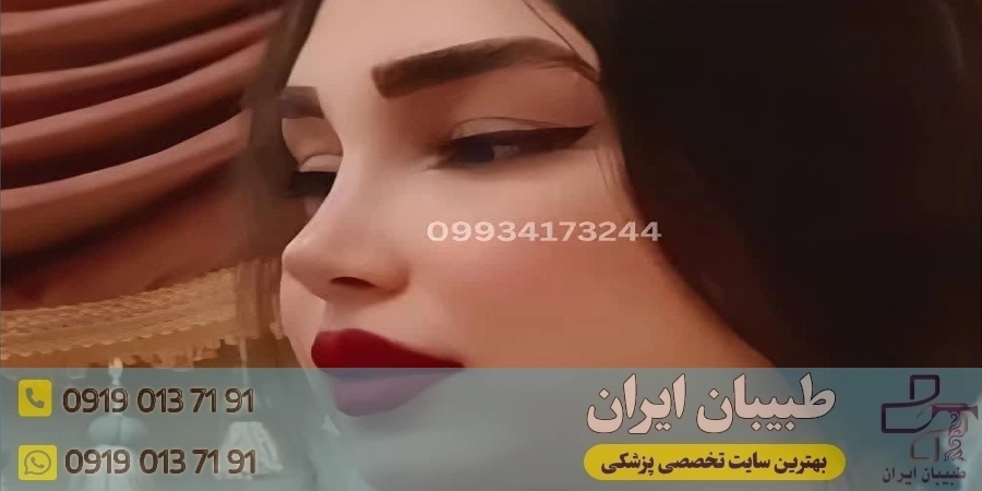 دکتر آرزو خوانساری_نیا (بهترین دکتر بینی نیمه فانتزی در تهران)
