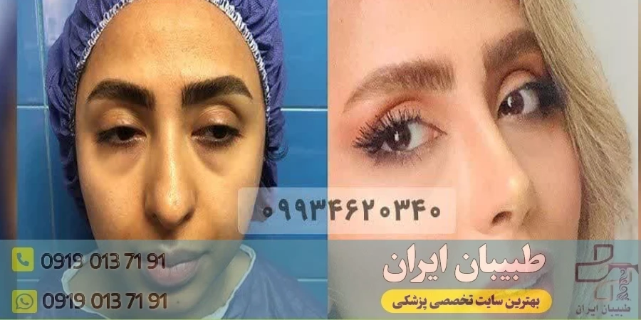 دکتر اکبر اعتمادی(بهترین جراح بینی نیمه فانتزی تهران)