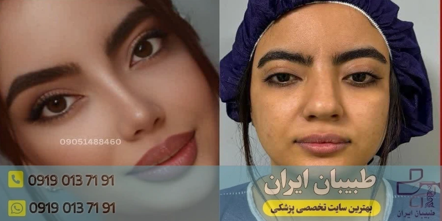 دکتر خسرو مقتدر (بهترین متخصص بینی نیمه فانتزی در تهران)