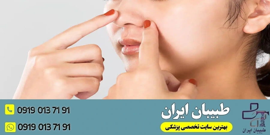 راهکارهای کنترل چربی پوست بعد از عمل بینی- آکنه بعد از عمل بینی