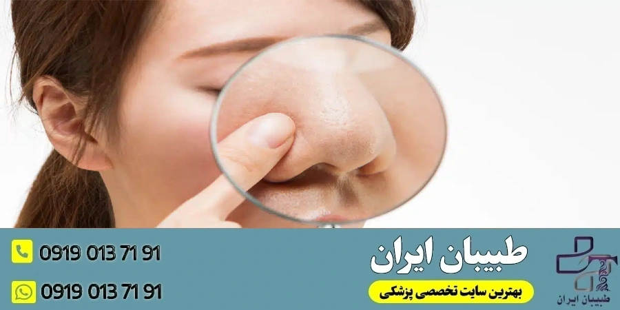 چه کسانی کاندیدای مناسب برای جراحی بینی استخوانی هستند؟