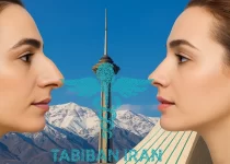 بهترین جراح بینی استخوانی در تهران- طبیبان ایران
