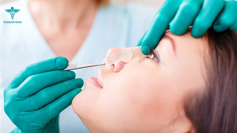 بهترین جراح بینی در تهران (راهنمای کامل ۱۴۰۵)