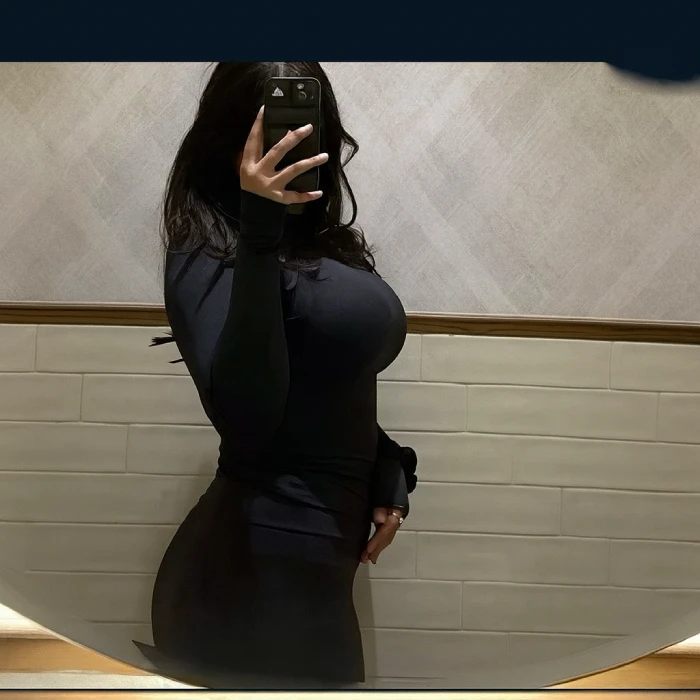 نمونه عمل پروتز سینه توسط دکتر امین بختیاری | بهترین جراح پروتز سینه در تهران | نمونه ۱