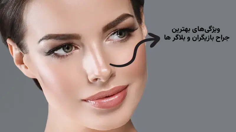 ویژگیهای بهترین جراح بینی بازیگران و بلاگرها: