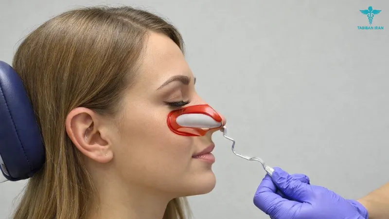 جراحی بینی بدون تامپون چیست؟