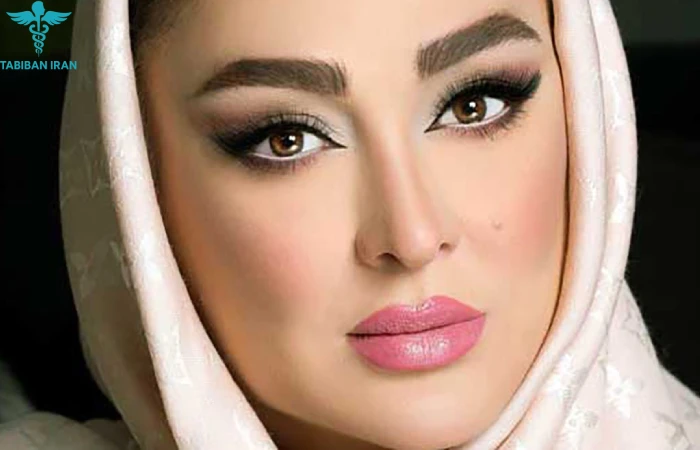 ترند ۱۰ – تأثیر اینفلوئنسرها و بازیگران بر انتخاب مدل بینی