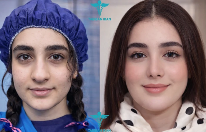 ترند ۴ – کاهش چشمگیر جراحیهای ترمیمی بهدلیل پیشرفت تکنیکها