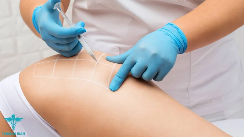 مقایسه عوارض احتمالی و میزان ایمنی دستگاه_های لاغری موضعی