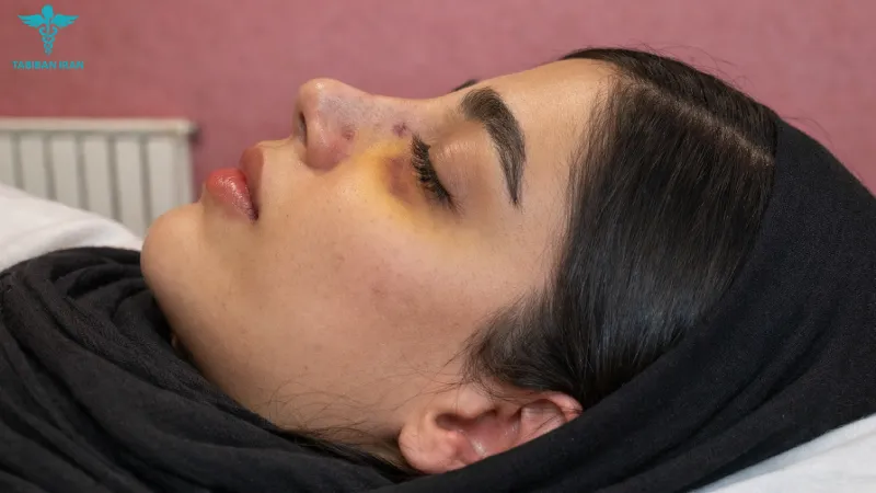 چرا جراحی بینی بعد از ۳۰ سالگی اینقدر مورد توجه قرار گرفته است؟