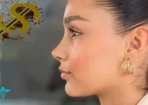 هزینه عمل بینی- طبیبان ایران