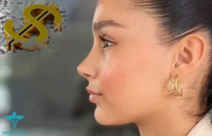 هزینه عمل بینی- طبیبان ایران