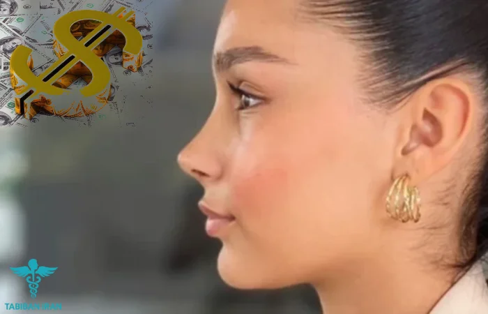 هزینه عمل بینی- طبیبان ایران