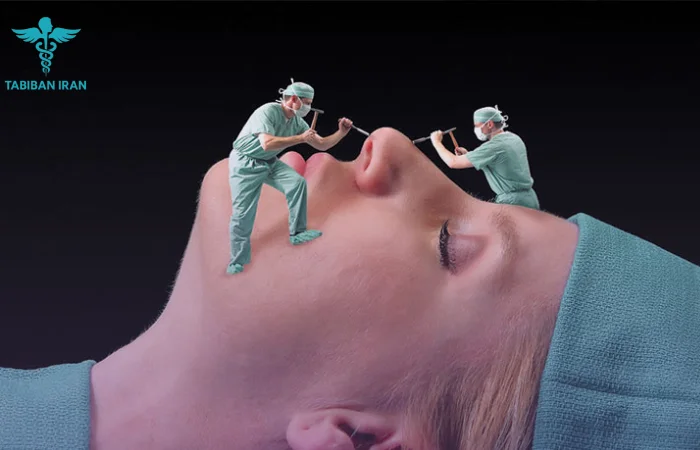 هزینه جراحی بینی