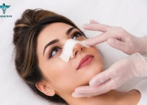 چسب زدن بینی تا چند ماه لازم است؟