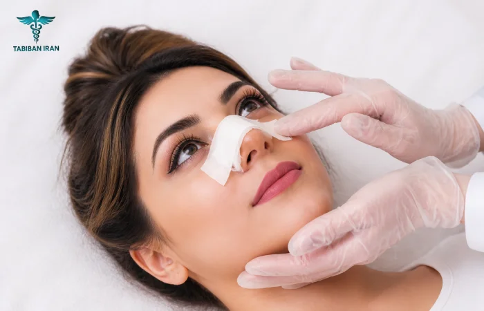 چسب زدن بینی تا چند ماه لازم است؟