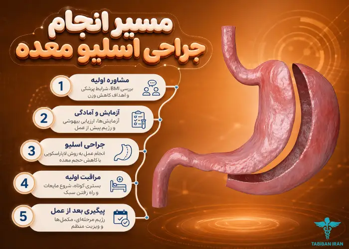 جراحی اسلیو معده چیست و چه مراحلی دارد؟